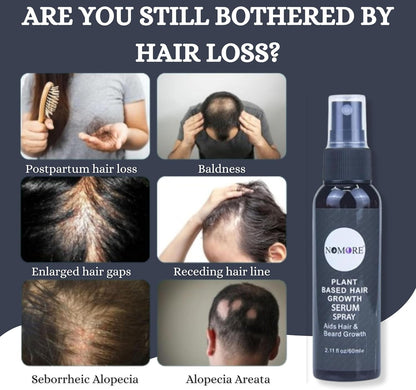 NOMORE Hair growth spray - Nurturing Scalp and Effective Hair Thickening for Women and Men