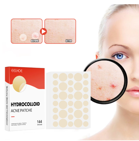 Acne patch applied to a spot on the chin