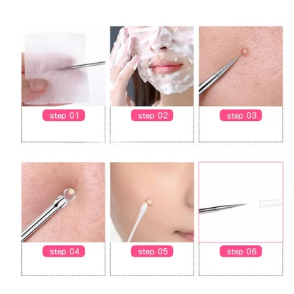 1pc Stainless Steel Blackhead Comedone Acne Blemish Extractor Remover Face Skin Care Pore Cleaner Needles Remove Tools Hot