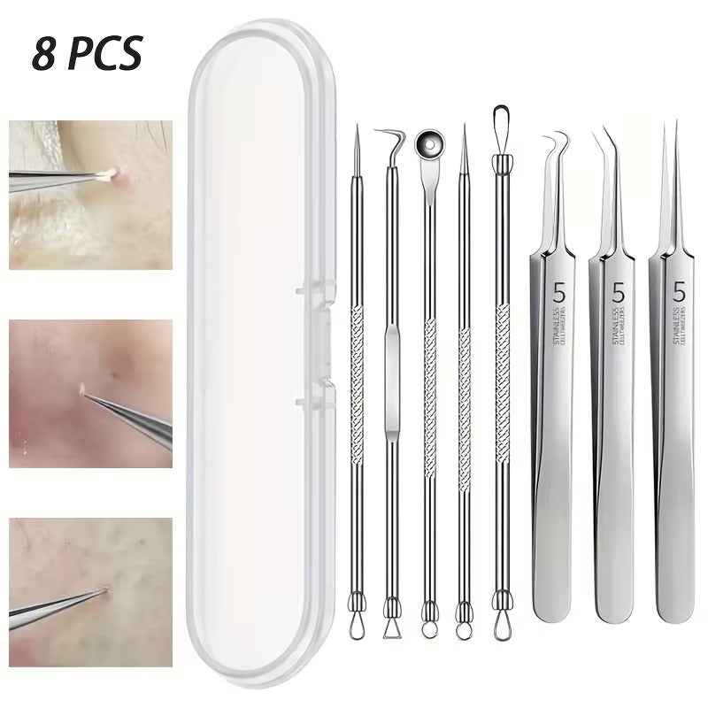 Stainless steel blackhead and blemish extraction tools laid out