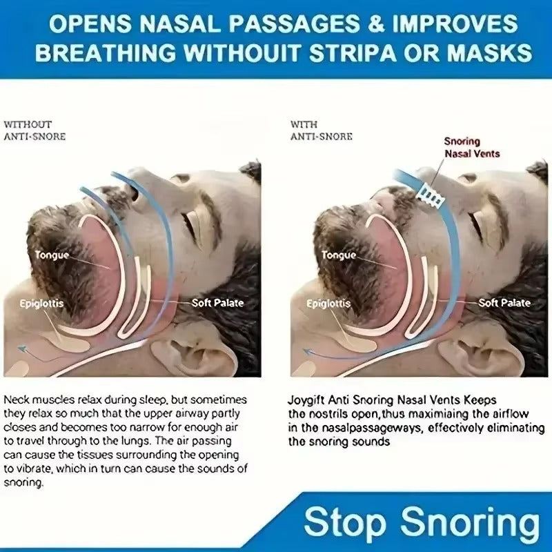 Mini Snore Stopper Anti Snoring Nasal Dilator Breathing Cones Congestion Aid Sleeping Aid Equipment Stop Snoring Nasal Dilators